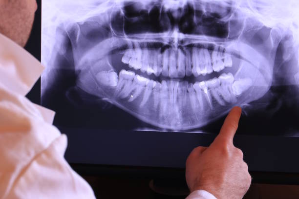 Emergency Dentist for Kids in SC